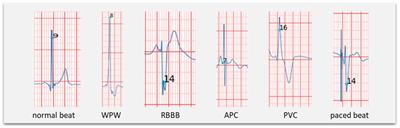 Frontiers Development of an AI based automated analysis of